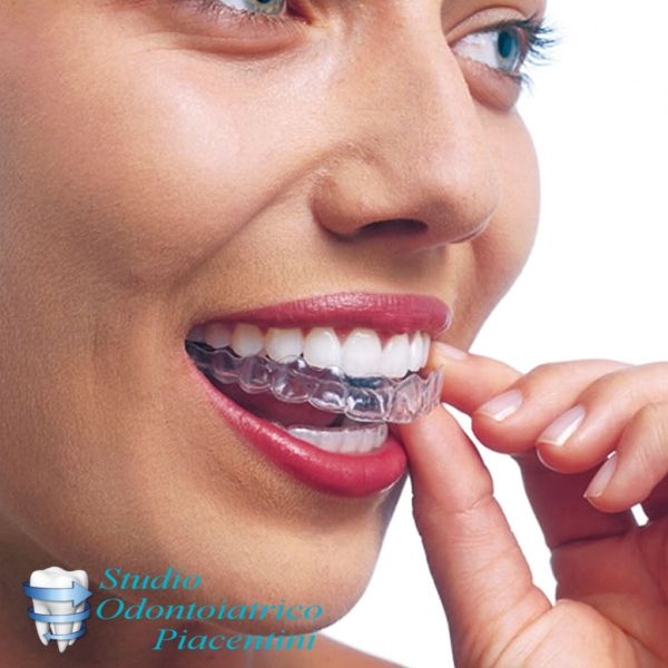 https://www.odontoiatriapiacentini.it/wp-content/uploads/2016/09/ortodonzia-invisibile-Invisalign-1.jpg
