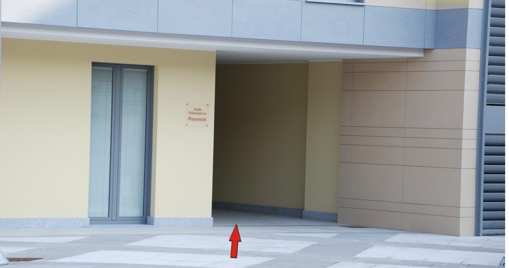 https://www.odontoiatriapiacentini.it/wp-content/uploads/2016/12/5-Pre-ingresso-freccia-1024x540.jpg